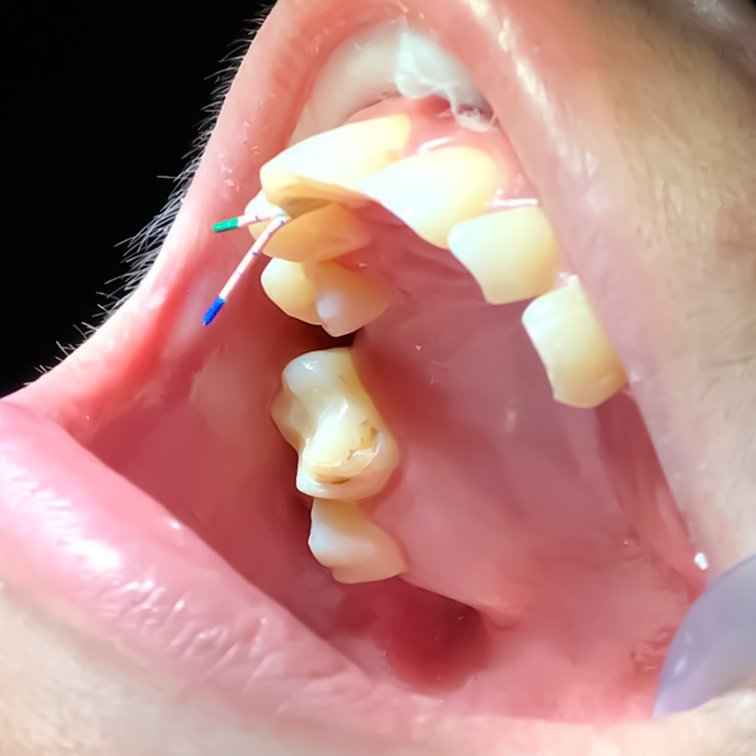 Orthodontics – veradentalclinicph